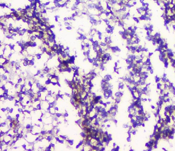 Anti-5HT2A Receptor/HTR2A Antibody