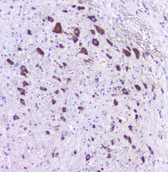 5HT2A Receptor/HTR2A Rabbit Polyclonal Antibody