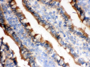 Anti-Isocitrate dehydrogenase/IDH1 Antibody