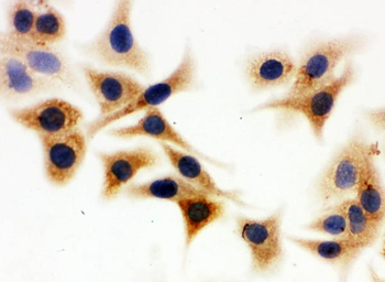 Anti-Isocitrate dehydrogenase/IDH1 Antibody
