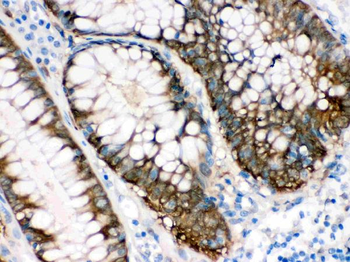 Anti-Isocitrate dehydrogenase/IDH1 Antibody