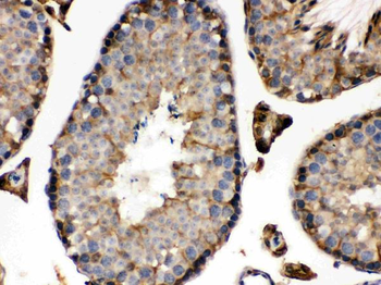 Anti-Isocitrate dehydrogenase/IDH1 Antibody