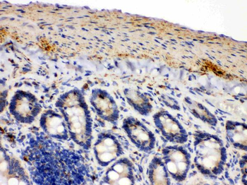 Anti-IDH2 Antibody