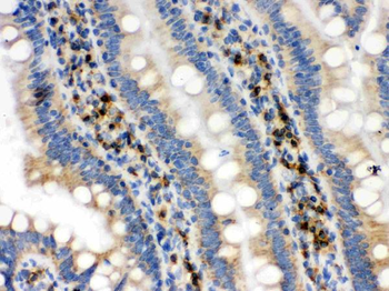 Anti-IDH2 Antibody