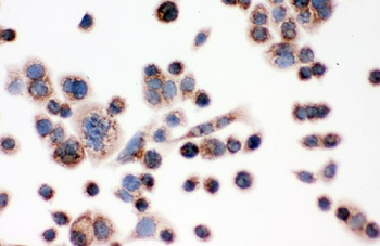 Anti-IDH2 Antibody