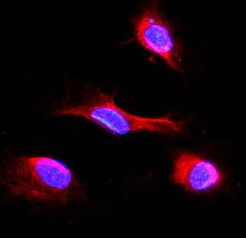 Anti-IDH2 Antibody