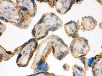 Anti-IDH2 Antibody