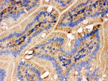 Anti-IDH2 Antibody