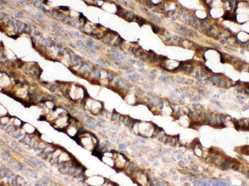 Anti-IDH2 Antibody