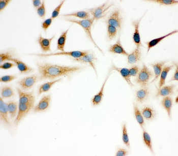 Anti-IDH2 Antibody