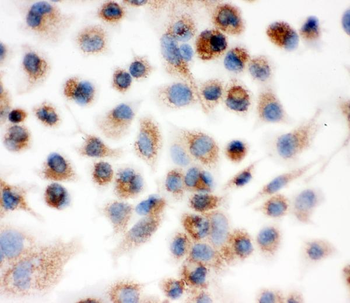 Anti-IDH2 Antibody