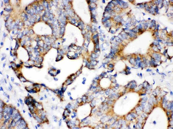 Anti-IDH2 Antibody