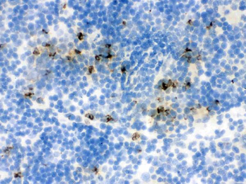 Anti-Lipocalin 2/LCN2 Antibody
