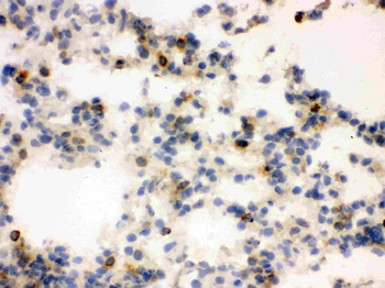 Anti-Lipocalin 2/LCN2 Antibody