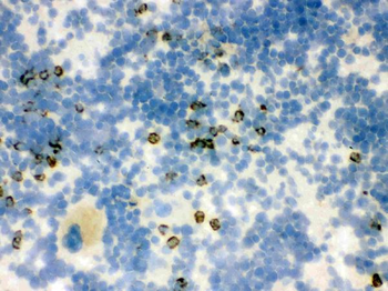 Anti-Lipocalin 2/LCN2 Antibody