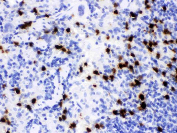Anti-Lipocalin 2/LCN2 Antibody