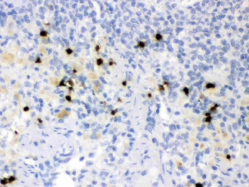 Anti-Lipocalin 2/LCN2 Antibody