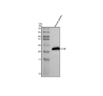 Anti-Lipocalin 2/LCN2 Antibody