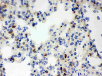 Anti-Lipocalin 2/LCN2 Antibody
