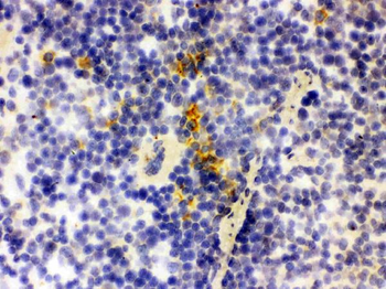 Anti-Lipocalin 2/LCN2 Antibody
