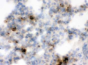 Anti-Lipocalin 2/LCN2 Antibody
