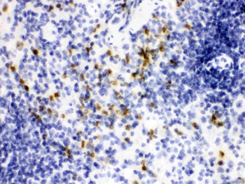 Anti-Lipocalin 2/LCN2 Antibody