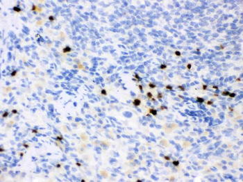 Anti-Lipocalin 2/LCN2 Antibody