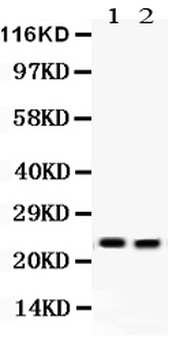 Anti-Lipocalin 2/LCN2 Antibody