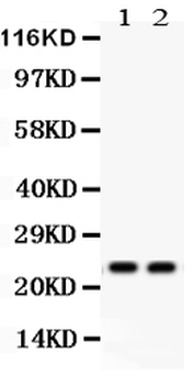 Anti-Lipocalin 2/LCN2 Antibody