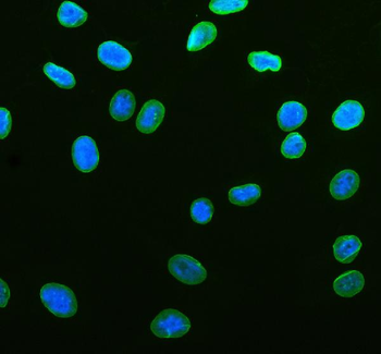 Anti-Lamin B1/LMNB1 Antibody