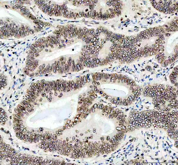 Anti-Lamin B1/LMNB1 Antibody
