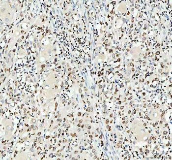 Anti-Lamin B1/LMNB1 Antibody