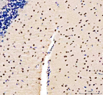 Anti-Lamin B1/LMNB1 Antibody