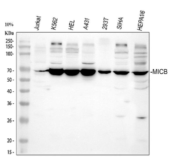 MICB Rabbit Polyclonal Antibody