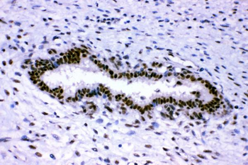 Anti-p95 NBS1/NBN Antibody