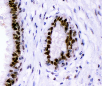 Anti-p95 NBS1/NBN Antibody