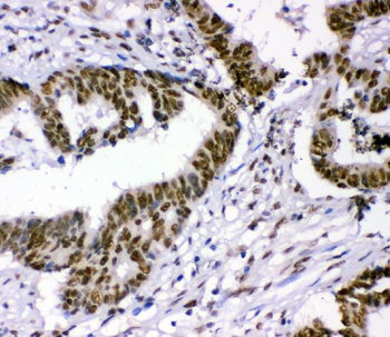 Anti-p95 NBS1/NBN Antibody