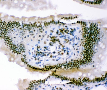 Anti-p95 NBS1/NBN Antibody