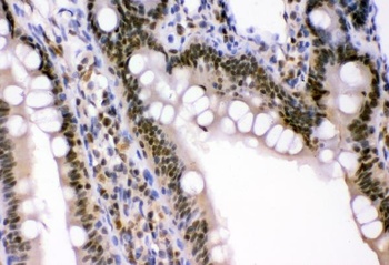 p95 NBS1/NBN Antibody