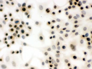 Anti-p95 NBS1/NBN Antibody