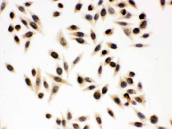 Anti-p95 NBS1/NBN Antibody