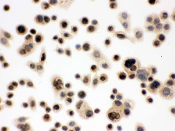 Anti-p95 NBS1/NBN Antibody