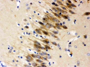 Anti-Otoferlin Antibody