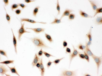 Anti-Surfactant protein D/SFTPD Antibody
