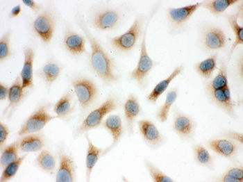 Anti-Surfactant protein D/SFTPD Antibody