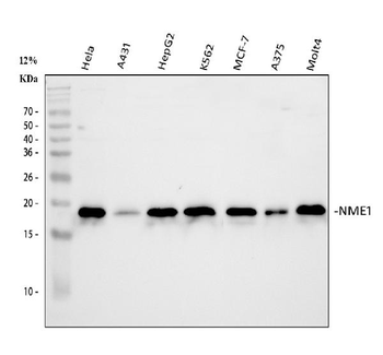 Anti-NM23A/NME1 Antibody