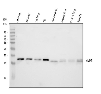 Anti-NM23A/NME1 Antibody