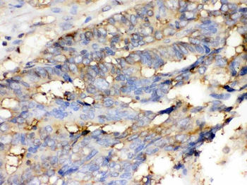 Anti-Cofilin/CFL1 Antibody