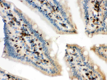 Anti-Cofilin/CFL1 Antibody