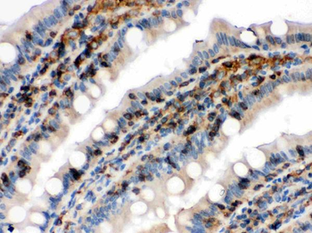 Anti-Cofilin/CFL1 Antibody
